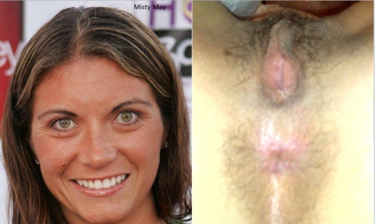 Misty May-Treanor figa